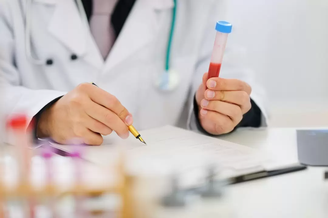 krvni test za parazite