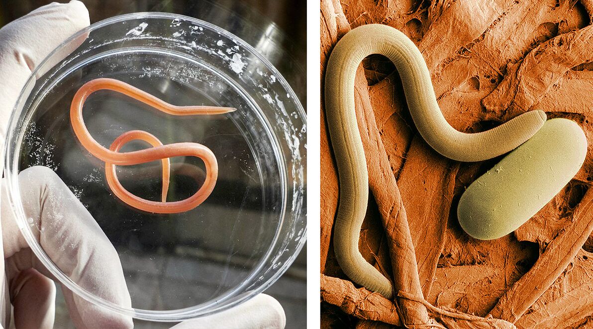 paraziti v človeškem telesu